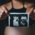 Breast Ultrasound vs Mammogram: Which One Do You Actually Need